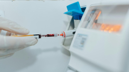 Dépistage du VIH sans rendez-vous ce 1er décembre à Nice