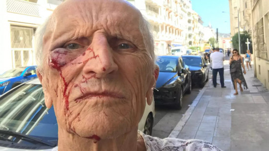 Docteur octogénaire agressé à Nice : le suspect interpellé et placé en garde à vue Docteur octogénaire agressé à Nice : le suspect interpellé et placé en garde à vue